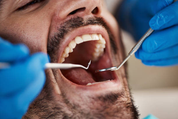 Best Emergency Dental Services for Seniors in Grove City, OH